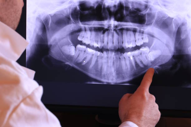 Best Emergency Cosmetic Dentistry in Largo, MD