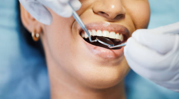 Best Emergency Dentist for Lost Fillings or Crowns in Largo, MD